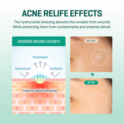 30 Days Miracle Clear Spot Patch [18 pcs] - SOME BY MI